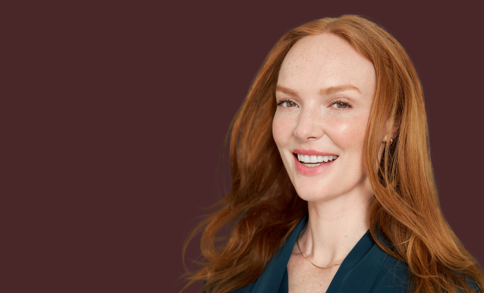 ジュビダームビスタ ボリフトXC